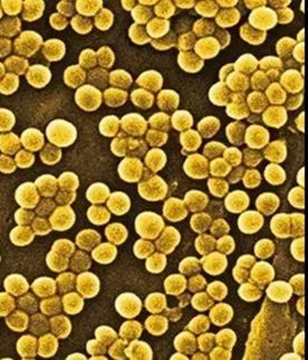 【硬核净化】疫情来袭,科菲笛抗菌防霉板为健康保驾护航